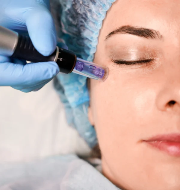 microneedling in golden, co at Restorative health of Colorado